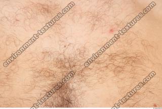 human skin hairy 0002